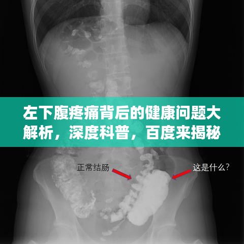 左下腹疼痛背后的健康问题大解析，深度科普，百度来揭秘！