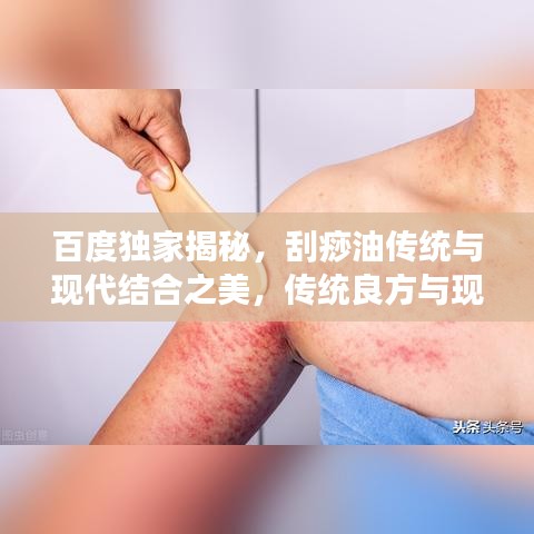 百度独家揭秘，刮痧油传统与现代结合之美，传统良方与现代科技的完美融合！