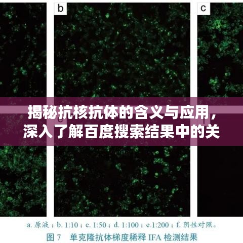 揭秘抗核抗体的含义与应用，深入了解百度搜索结果中的关键信息