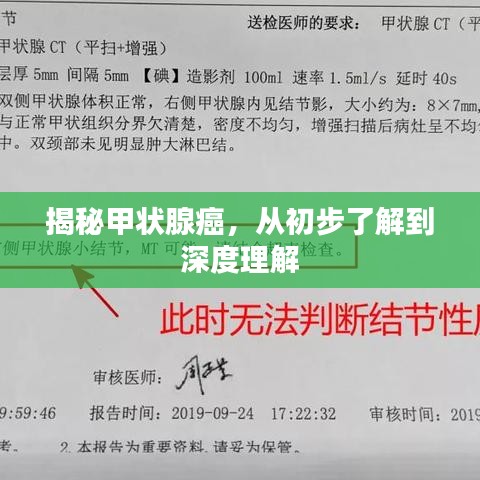 揭秘甲状腺癌，从初步了解到深度理解